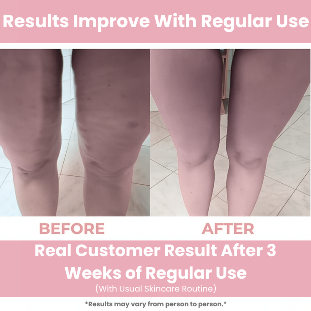 Cellubrae™  Massage Roller